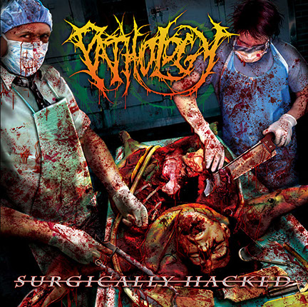 Pathology - Surgically Hacked Album Cover Artwork by Mike Hrubovcak / Visualdarkness.com